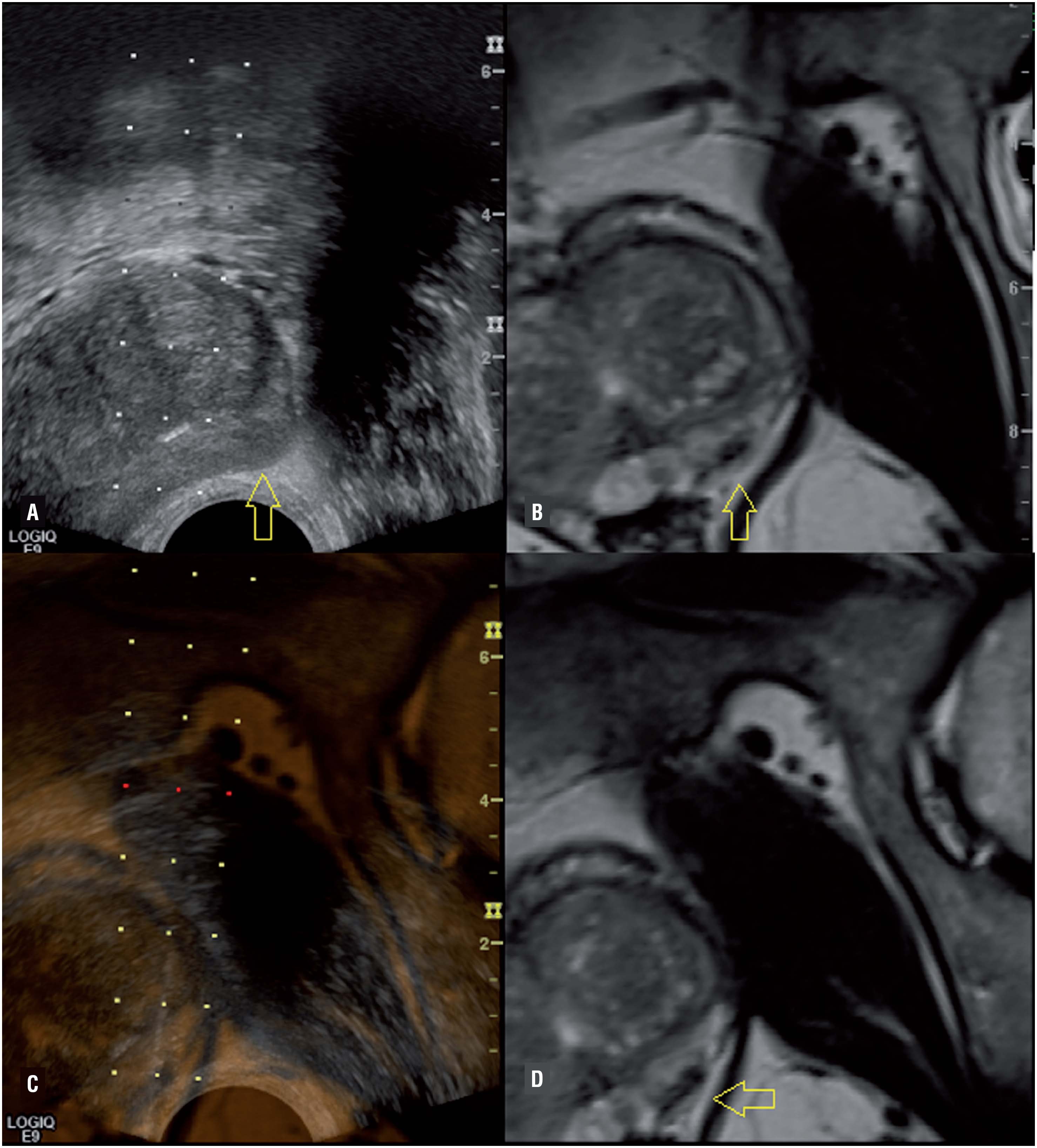 3T MRI image of the prostate
