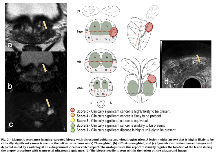 mpMRI images and clinical significance scores