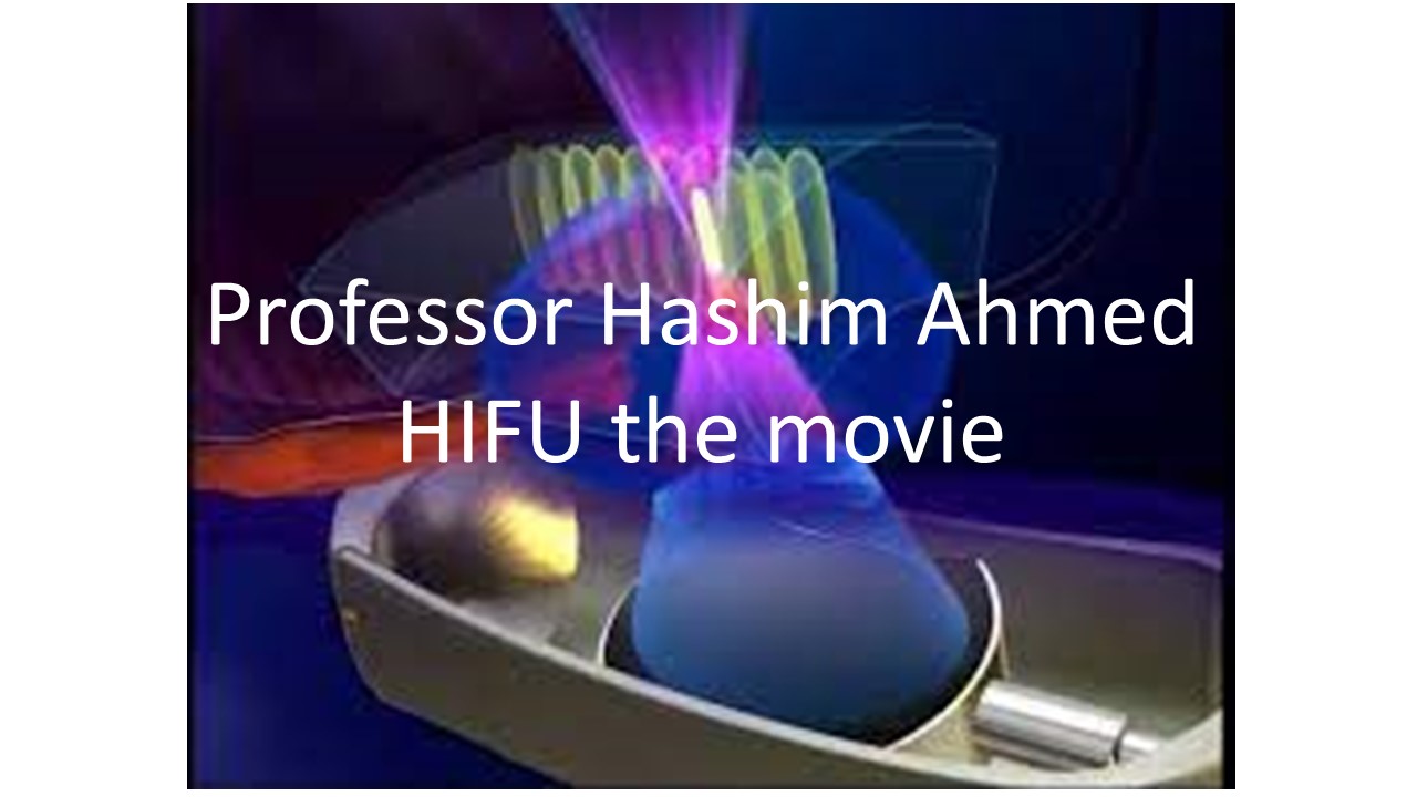 Professor Hashim Ahmed presents HIFU the movie